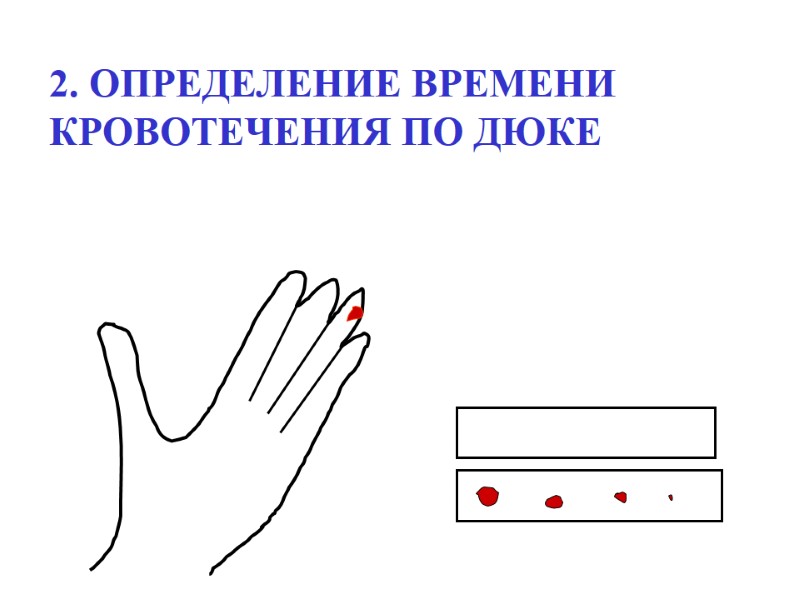 2. ОПРЕДЕЛЕНИЕ ВРЕМЕНИ  КРОВОТЕЧЕНИЯ ПО ДЮКЕ